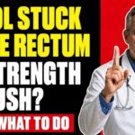 The Older You Are, the Longer You Wait STOOL STUCK in the RECTUM After 60! What It Is and What To Do IMMEDIATELY