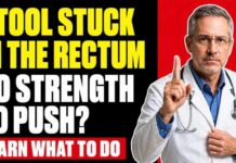 STOOL STUCK in the RECTUM After 60! What It Is and What To Do IMMEDIATELY