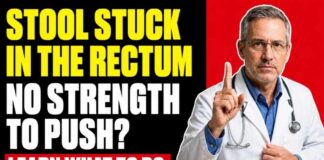 STOOL STUCK in the RECTUM After 60! What It Is and What To Do IMMEDIATELY